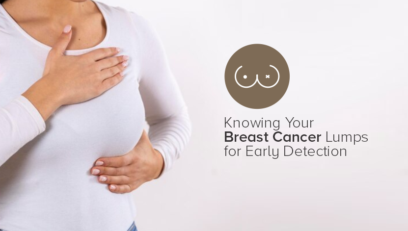 Knowing Your Breast Cancer Lumps For Early Detection